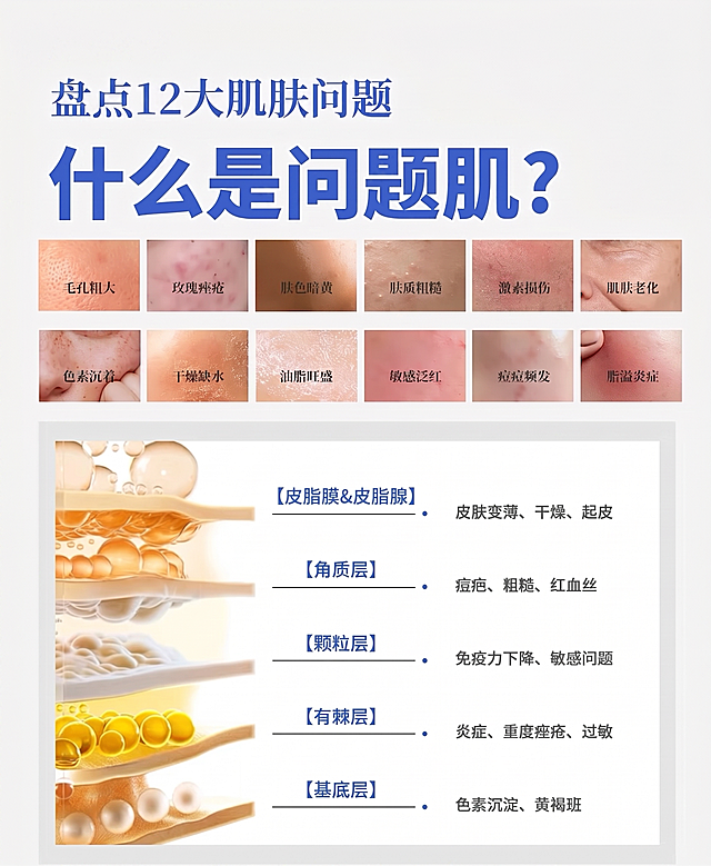 去掉LOGO和品牌名字