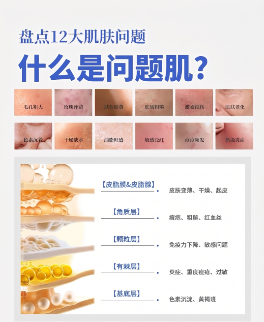 去掉LOGO和品牌名字预览效果