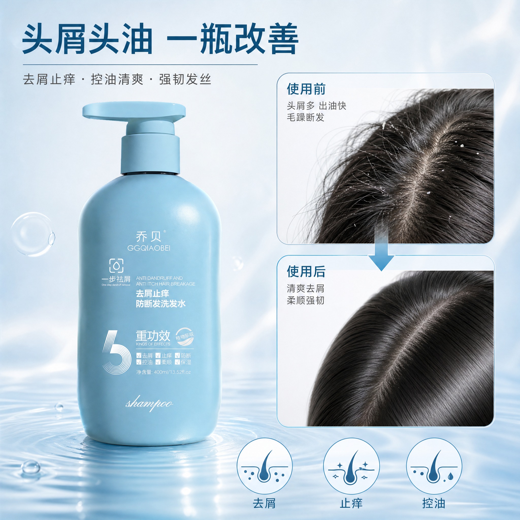 [主图-4] 痛点解决与使用效果展示，呈现去屑止痒控油的发质改… - 图片创意预览