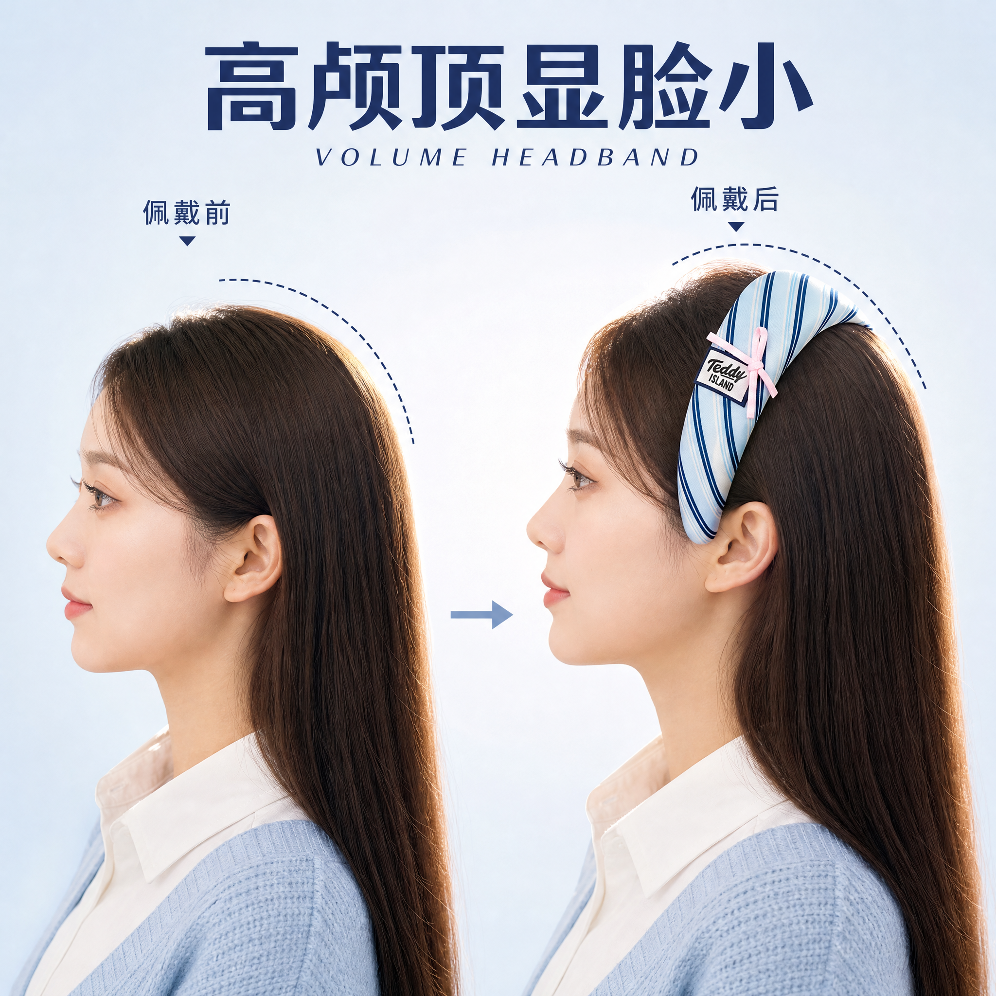 [主图-3] 泰迪爱兰学院风条纹发箍 高颅顶效果侧面展示。 [… - 图片创意预览